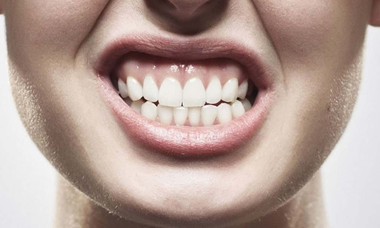 bruxismo que es sintomas tratamiento dentum